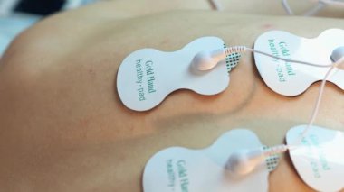 Elektroterapi. Fizyoterapi prosedürü, sırt kaslarının miostimülasyonu. Yüksek kalite 4k görüntü