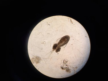 Mikroskop altında alt kabuklu deniz hayvanı. Yüksek kalite fotoğraf