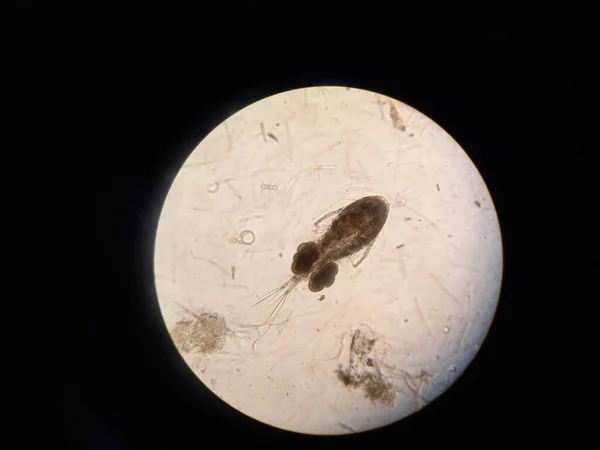 Crustacé Inférieur Sous Grossissement Microscope Photo Haute Qualité — Photo