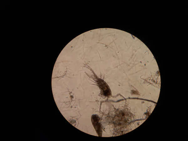 Crostacei Inferiori All Ingrandimento Del Microscopio Foto Alta Qualità — Foto Stock