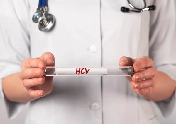 Acronimo HCV per test medici. Tubo di prova Word — Foto Stock