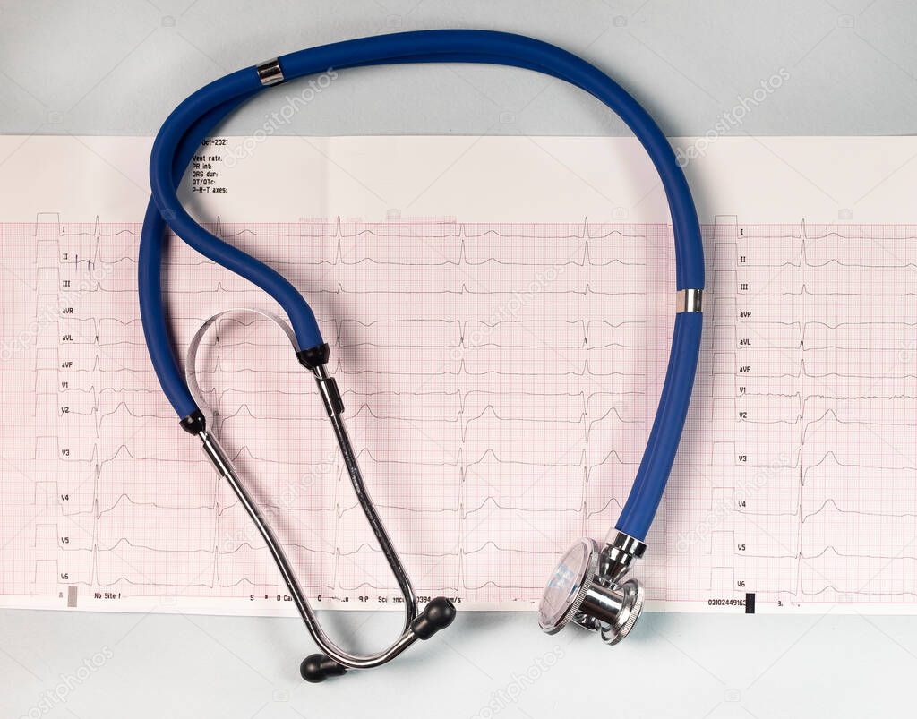 Cardiogram background through magnifying glass, cardiology. ECG and stethoscope