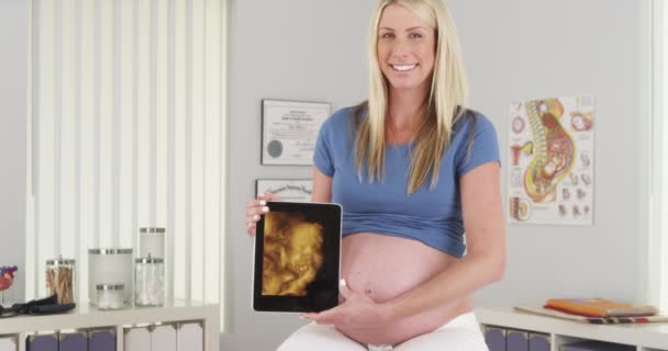 Kobieta Ciąży Trzyma Xray Dziecka Tabletki — Wideo stockowe