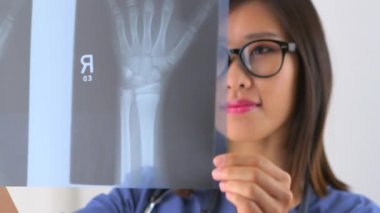 Çinli kadın doktor röntgeni inceliyor.