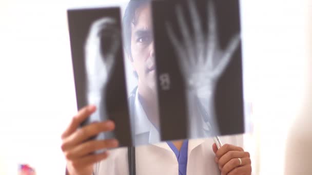 Meksykański Lekarz Dokonujący Przeglądu Prześwietleń Dłoni — Wideo stockowe