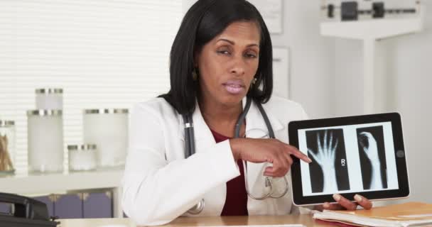 Médecin Africaine Senior Parlant Radiographie Des Mains — Video