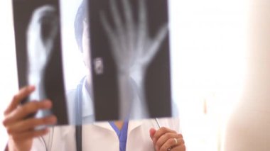 İspanyol doktor el röntgenlerini inceliyor.