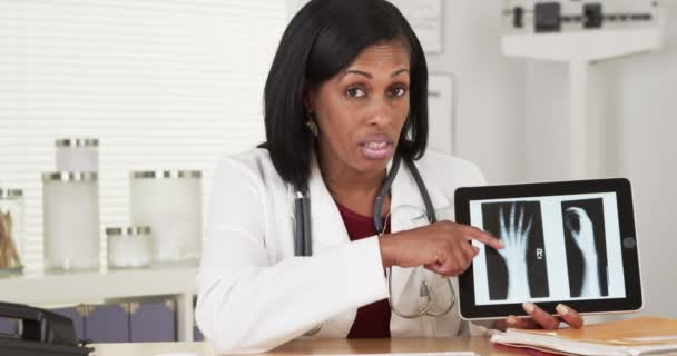 高级黑人女医生进行手部X光检查 — 图库视频影像