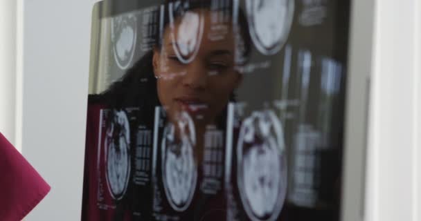 Işınları Gözden Doktorlar Beyin — Stok video