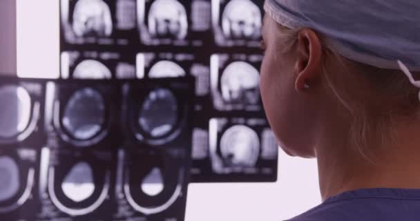 Женщина Хирург Смотрит Рентген Разговаривает Коллегой — стоковое видео