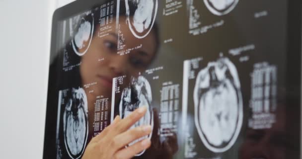 Dva Lékaři Kontrolující Rentgeny Mozku — Stock video