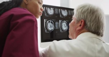 İki doktor beyin röntgenlerini tartışıyor.