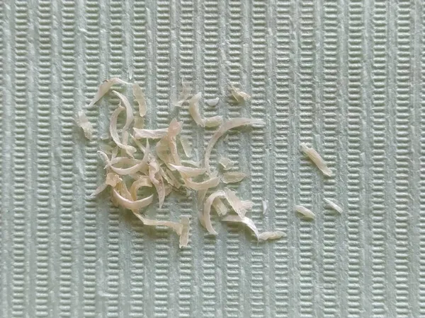 Clipped human nails on a napkin, close-up