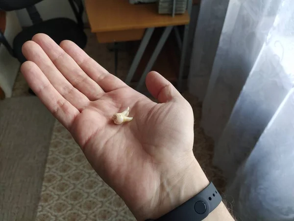 Man Hand Holds Extracted Tooth — Stock Photo, Image