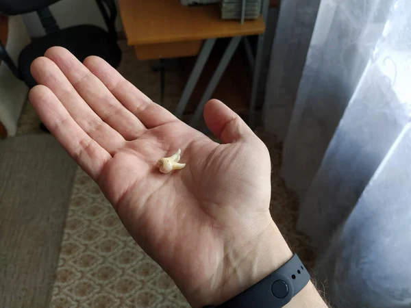 Man Hand Holds Extracted Tooth — Stock Photo, Image