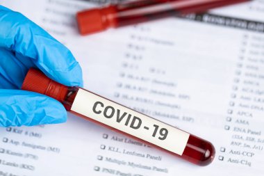 Araştırma laboratuarında kan tüpü testi yapan bir teknisyen. Coronavirus testi. Doktor kan örneği tüpü alıyor.