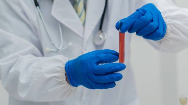 Mavi eldivenli doktorun elinde çalışma için laboratuarda bir şişe kan örneği var.