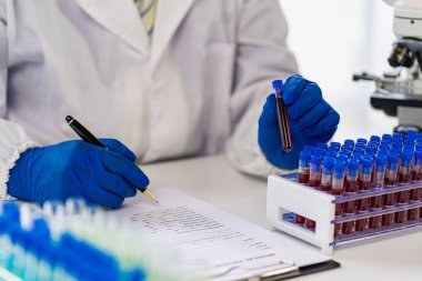Bilimadamları laboratuvar tıbbi konseptinde üzerinde kan olan bir test tüpünü tutuyorlar.