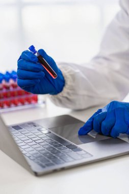 Laboratuvar asistanı deneysel bir kan damarı buldu. Tıbbi araştırmacılar mikroplardan korunmak için lastik eldiven takarlar. Laboratuvar araştırması yapan hastaların kan damarlarını göster.