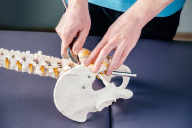 Fizyoterapist, esnek kiropraktik omurga modelinde sakroiliak eklem ağrısını tedavi etmek için IASTM aracının nasıl uygulanacağını gösteriyor.