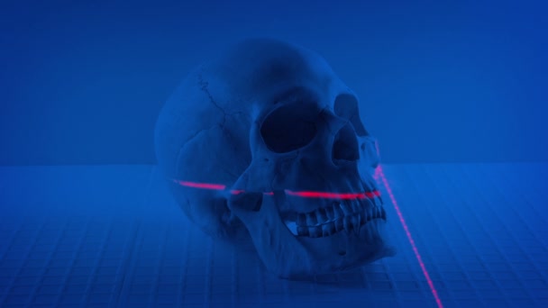 Laser Scans Skull Laboratory — Stock videók