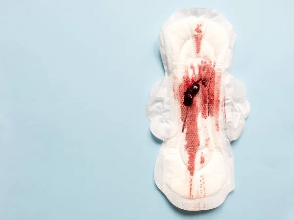 Symptom Einer Endometriose Menstruationsblut Mit Blutgerinnseln Auf Einem Hygienepad — Stockfoto