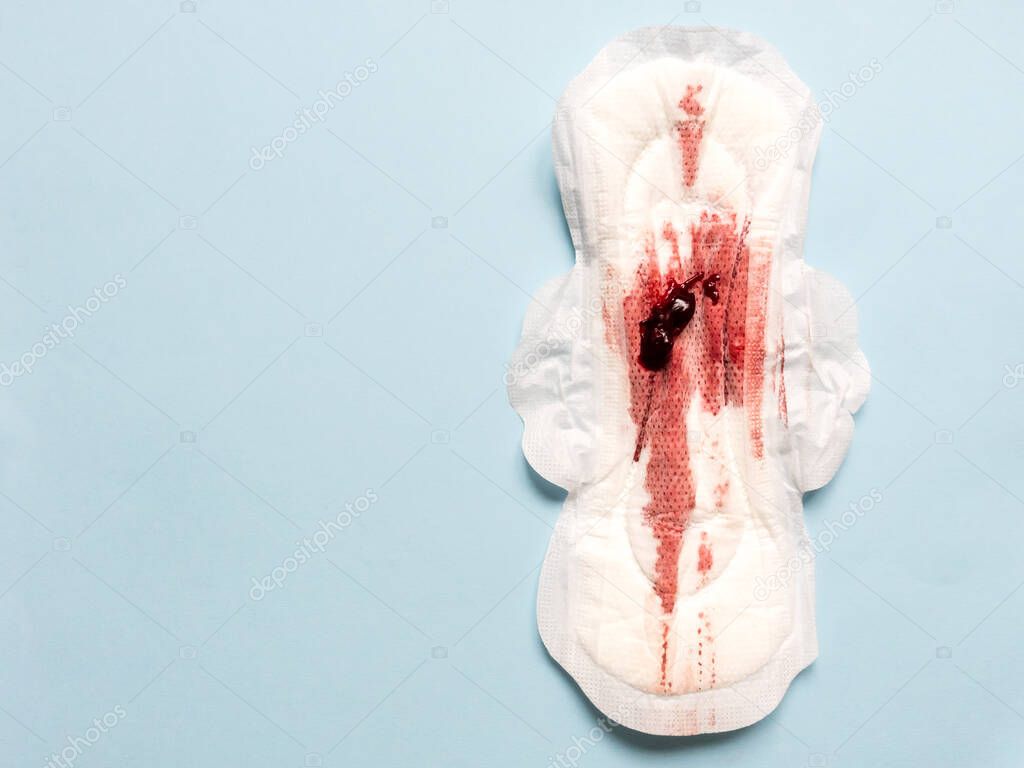 Symptom of endometriosis, menstrual blood with blood clots on a sanitary pad.
