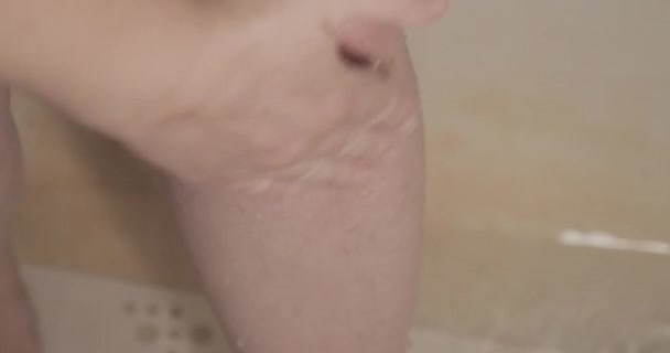 Kobieta myje i dezynfekuje ranne kolano. — Wideo stockowe