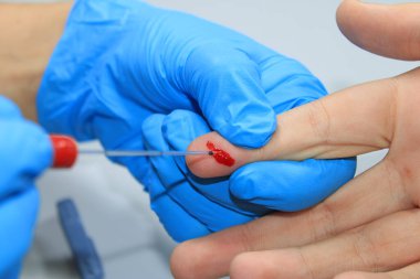 Healthcare hand taking blood sample from a finger