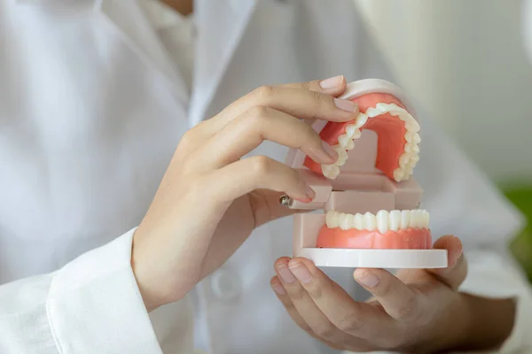 Los Dentistas Sostienen Modelos Dentales Utilizados Para Consultas Cuidado Dental —  Fotos de Stock