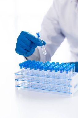 Bir laboratuvar asistanı, bir tıp bilimcisi, bir kimya araştırmacısı bir test tüpü tutuyor ve bir hastanın kan örneğinden hastalığı inceliyor. Tıp ve araştırma konsepti.