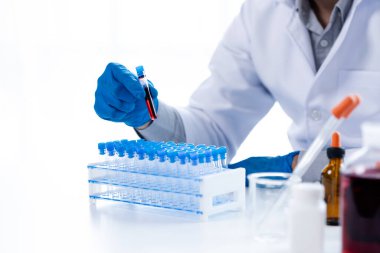 Lab assistant, a medical scientist, a chemistry researcher holds a glass tube through the blood sample, does a chemical experiment and examines a patient's blood sample. Medicine and research concept.