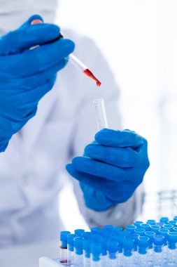 Laboratuvar asistanları kimyasal reaksiyonları, tıbbi bilimcileri, kimyasal araştırmacıları, kimyasal deneyleri ve hasta kan örneklerinden yapılan hastalık testlerini araştırıyorlar. Tıp ve araştırma konsepti