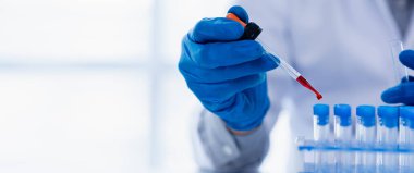 Laboratory assistants are investigating chemical reactions, medical scientists, chemical researchers, chemical experiments and disease testing from patient blood samples. Medicine and research concept