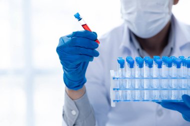 Laboratuvar asistanı, tıp bilimcisi, kimya araştırmacısı kan örneğinde cam bir tüp tutuyor, kimyasal bir deney yapıyor ve hastanın kan örneğini inceliyor. Tıp ve araştırma konsepti.