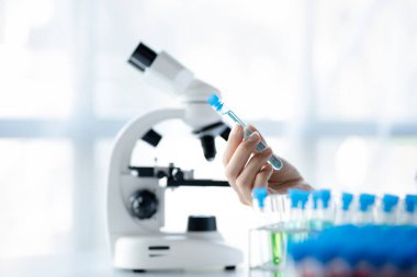 Bir laboratuvar asistanı, bir tıp bilimcisi, bir kimya araştırmacısı bir test tüpü tutuyor ve bir hastanın kan örneğinden hastalığı inceliyor. Tıp ve araştırma konsepti.