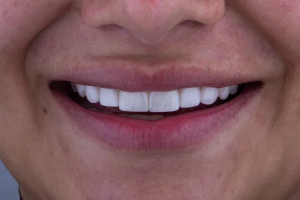 Sorria Com Dentes Saudáveis Bonitos — Fotografia de Stock
