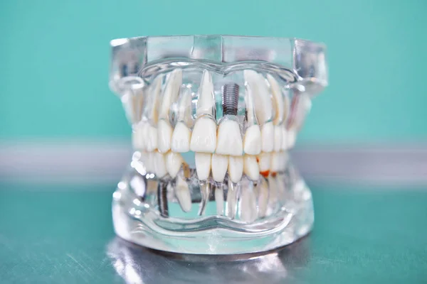 Transparent Model Human Jaw Oral Dental Hygiene Concept Dental Dentistry — Stock Photo, Image