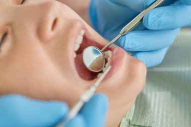 Yakın plan kadın diş muayenesi yaptırıyor. Klinikteki kazıcı ile dişçiye muayene oluyor. Hastasında güzel bir gülümseme var mı diye.