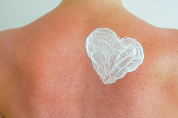 Cream Shape Heart Human Skin Sunburn Moisturizing Nourishing Sun Cream — Stock Photo, Image