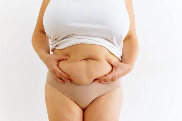 stock image overweight woman holding her belly. turgor of loose skin is lost.