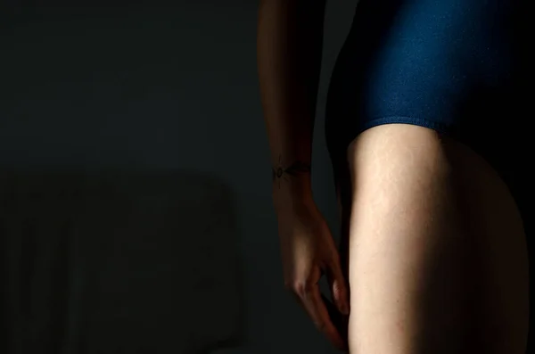 Stretch Marks Legs Weight Loss Close Background Texture Skin Care — Fotografia de Stock