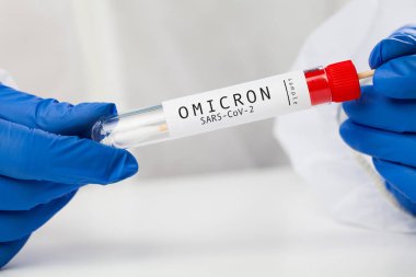 Tıbbi NHS sağlık uzmanı COVID-19 bez toplama kiti tutuyor, beyaz PPE koruyucu giysi ve eldiven giyiyor, Omicron hasta numunesi almak için test tüpü, PCR test süreci