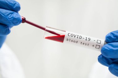 Hasta kan örneğiyle COVID-19 test tüpü, Coronavirus 'un yeni varyasyonu için serolojik laboratuvar testi, mikroskobik inceleme için pipeti dolduran mavi koruyucu lateks eldivenler.