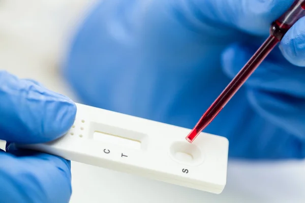 Macro Closeup Hands Blue Protective Latex Gloves Holding Rapid Diagnostic — стоковое фото