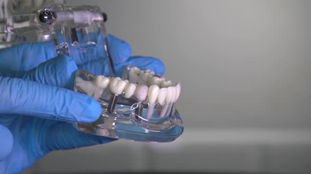 Modelo Mandíbula Humana Con Implantes Las Manos Del Dentista Laboratorio — Vídeos de Stock