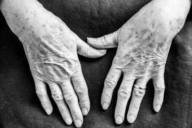 Yaşlı adamın elleri. Siyah beyaz geçmişi olan yaşlı bir kadının kırışık ellerine yakın durun. Yaşlı adam siyah beyaz konsept veriyor. Yaşlı bir insanın buruşuk elleri