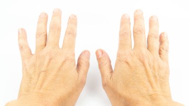 Beyaz arka planda orta yaşlı bir kadının elleri. Kadın elinin kırışıklıkları. Cilt bakımı kavramı.