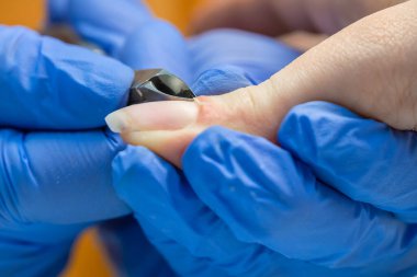 Mavi eldivenli bir manikür ustasının yakın çekimi bir kadın için manikür yapar, profesyonel tırnak maşasıyla tırnak derisini keser. Bir güzellik salonunun kliniğinde profesyonel manikür..