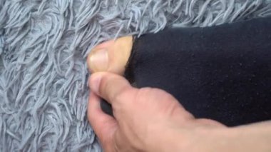 Adam ayak tırnaklarını makasla kesiyor. Sünnetsiz ve düzensiz tırnakları nedeniyle çorabı kırıldı. Yoksulluk ve mutsuzluk. Yırtık çoraplar ve tembel adam.